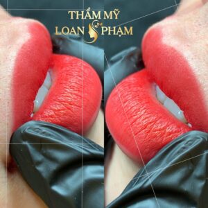 Thẩm Mỹ Loan Phạm