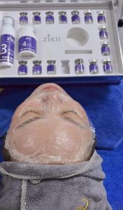 Trẻ Hóa Da Với Liệu Pháp Meso Tơ Tằm Không Tiêm (Zikii)